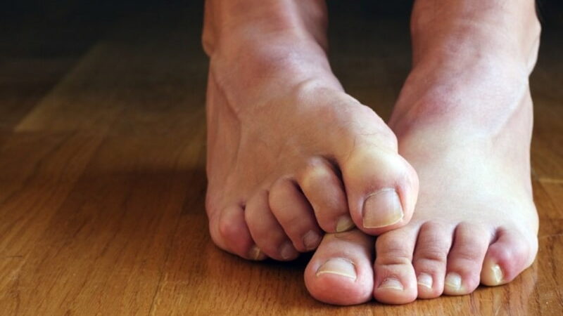 В Полоцке женщина голая ходила в магазин