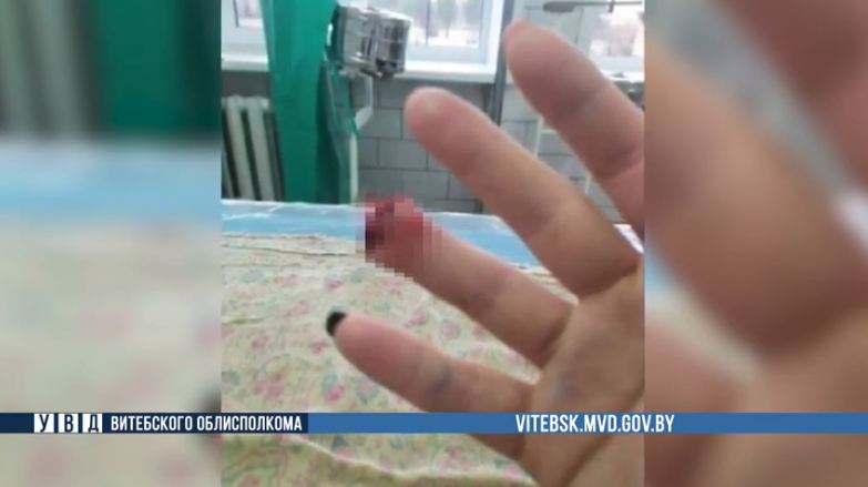 откусила палец